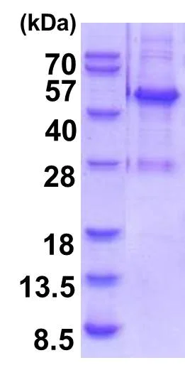 SDS-PAGE - Recombinant Human ELAC1 protein (AB201882)