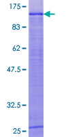 Recombinant Human ELAC2 protein