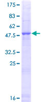 Recombinant Human Elastase-1 protein
