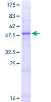 SDS-PAGE - Recombinant Human Elastase-1 protein (AB158343)
