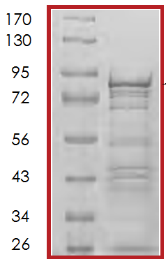 SDS-PAGE - Recombinant Human ELK1 protein (AB70380), expandable thumbnail
