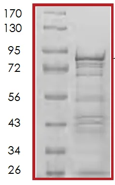 SDS-PAGE - Recombinant Human ELK1 protein (AB70380)