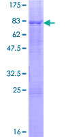 Recombinant Human ELK4 protein