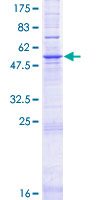 SDS-PAGE - Recombinant Human ELOVL2 protein (GST tag N-Terminus) (AB162883)