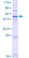 SDS-PAGE - Recombinant Human ELOVL2 protein (GST tag N-Terminus) (AB162883)