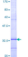 SDS-PAGE - Recombinant Human ELOVL4 protein (AB159600), expandable thumbnail