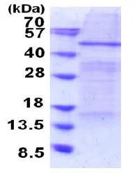 SDS-PAGE - Recombinant Human Elp4 protein (denatured) (AB187472)