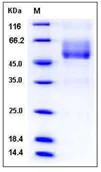 SDS-PAGE - Recombinant Human EMA protein (Fc Chimera) (AB276462)