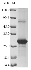 SDS-PAGE - Recombinant Human EMC4 protein (AB289744)