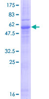 Recombinant Human Emerin protein