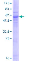 SDS-PAGE - Recombinant Human Emerin protein (GST tag N-Terminus) (AB112283)