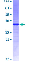 Recombinant Human EMILIN2 protein
