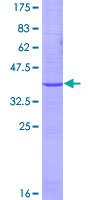 Recombinant Human EMP2 protein