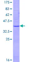 SDS-PAGE - Recombinant Human EMP2 protein (GST tag N-Terminus) (AB152364)