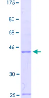 SDS-PAGE - Recombinant Human EN2 protein (GST tag N-Terminus) (AB158360)