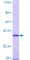 SDS-PAGE - Recombinant Human ENDOGL1/ENGL protein (AB160724)