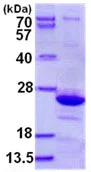 SDS-PAGE - Recombinant Human Endomucin protein (His tag N-Terminus) (AB130024)