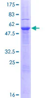 SDS-PAGE - Recombinant Human Endonuclease V protein (GST tag N-Terminus) (AB166165)