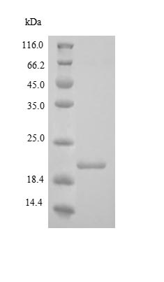 Recombinant Human Endostatin/COL18A1 protein (His tag)