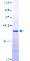 Recombinant Human Endothelin 1 protein