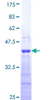 SDS-PAGE - Recombinant Human Endothelin 1 protein (AB158333)