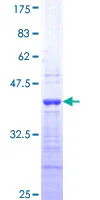SDS-PAGE - Recombinant Human Endothelin 1 protein (GST tag N-Terminus) (AB158333)