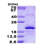 SDS-PAGE - Recombinant Human Endothelin 2/ET-2 protein (denatured) (His tag N-Terminus) (AB140557)