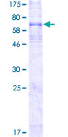 Recombinant Human Endothelin B Receptor/ET-B protein