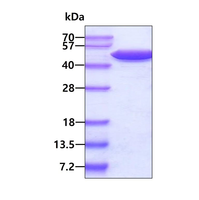 SDS-PAGE - Recombinant human ENO1 protein (Active) (AB89248)