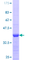 SDS-PAGE - Recombinant Human eNOS protein (AB112329), expandable thumbnail