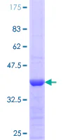 SDS-PAGE - Recombinant Human eNOS protein (AB112329)