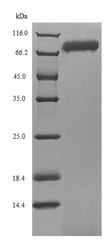 SDS-PAGE - Recombinant Human ENOX1 protein (His tag) (AB235676)
