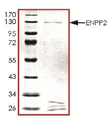 SDS-PAGE - Recombinant Human ENPP2/ATX protein (AB126918)