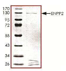 SDS-PAGE - Recombinant Human ENPP2/ATX protein (Tag Free) (AB126918)