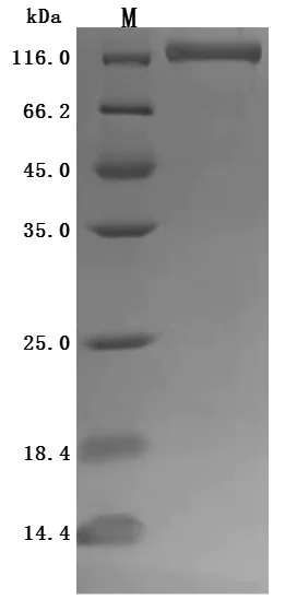 SDS-PAGE - Recombinant human ENPP3/B10 protein - Active (His tag) (AB314534)