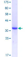 SDS-PAGE - Recombinant Human ENPP3/B10 protein (GST tag N-Terminus) (AB159085)