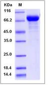 SDS-PAGE - Recombinant Human ENPP5 protein (His tag) (AB276401)
