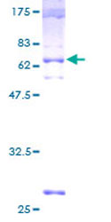 Recombinant Human ENT2 protein