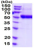 SDS-PAGE - Recombinant Human ENTPD3 protein (His tag) (AB219293)