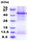 SDS-PAGE - Recombinant Human ENTPD6 protein (denatured) (His tag N-Terminus) (AB183226)