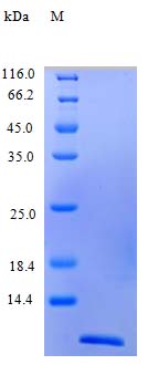 Recombinant human Eotaxin protein (Active)
