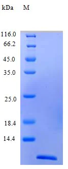 SDS-PAGE - Recombinant human Eotaxin protein (Active) (AB243753)