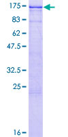 Recombinant Human EPB41 protein