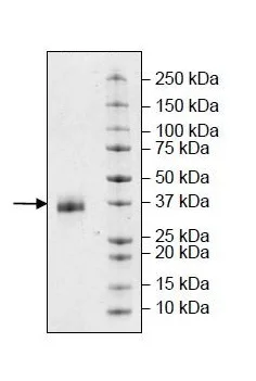 SDS-PAGE - Recombinant Human EpCAM protein (Biotin) (Avi tag C-Terminus + His tag C-Terminus) (AB269993)