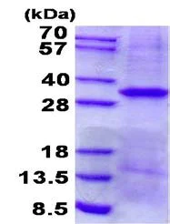 SDS-PAGE - Recombinant Human EpCAM protein (denatured) (His tag N-Terminus) (AB139217)