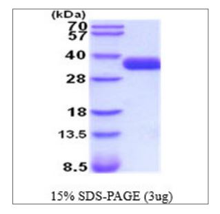 SDS-PAGE - Recombinant Human EpCAM protein (His tag) (AB270570), expandable thumbnail