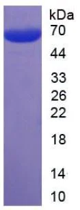 SDS-PAGE - Recombinant Human EpCAM protein (Tagged) (AB270594)