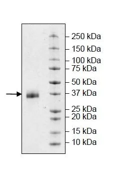 SDS-PAGE - Recombinant Human EpCAM protein (Tagged) (Biotin) (AB269993)