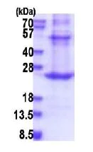 SDS-PAGE - Recombinant Human EPCR/CD201 protein (denatured) (His tag N-Terminus) (AB180310)