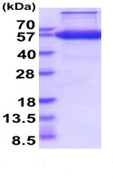 SDS-PAGE - Recombinant Human EPCR/CD201 protein (Fc Chimera His Tag) (AB222997)
